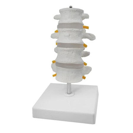 4 Lumbar Vertebrae with Nerve Branches Model, 7.25" Tall - Natural Size - Mounted on Base - Eisco Labs